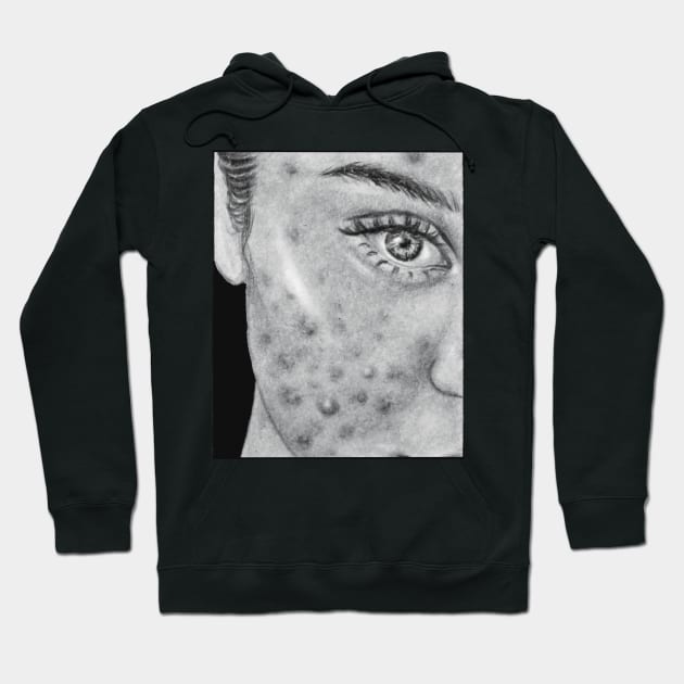 drawing insecurities acne pimples body positivity Hoodie by maoudraw